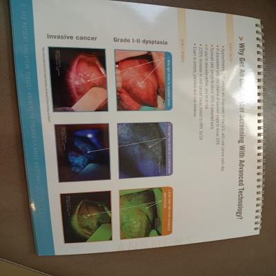 Oral Cancer Screening